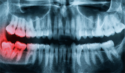 Самый счастливый день в моей жизни